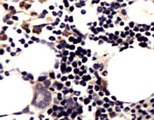 MMP-13 staining in rat cartilage. Formalin-fixed paraffin-embedded rat articular cartilage tissue is stained with MMP-13 (Cat. No. 251219) Antibody used at 1:200 dilution.
