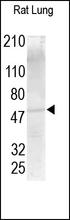 The MMP-13 (Cat. No. 251219) Antibody is used in Western blot to detect MMP-13 in rat lung.