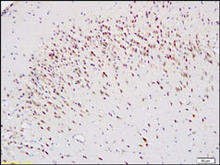 8-OHdG staining in rat brain. Formalin-fixed paraffin-embedded injured rat brain is stained with 8-OHdG Antibody (Cat. No. 251640) used at 1:200 dilution.
