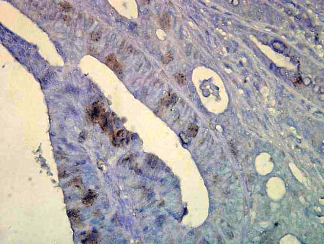 Anti-HSP70 Monoclonal Antibody (Clone : C92F3A-5) - HRP