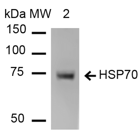 Anti-HSP70 Monoclonal Antibody (Clone : 1H11) - Alkaline Phosphatase