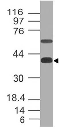 Monoclonal Antibody to CD161 (Clone: ABM2D74)