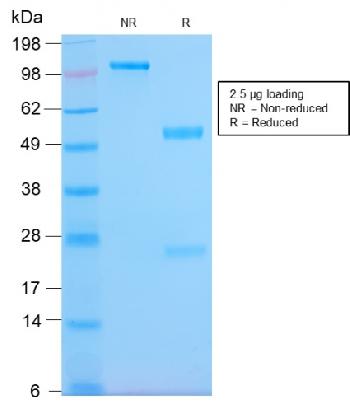Anti-HLA-Pan (MHC II) Monoclonal Antibody(Clone: HLA-Pan/2967R)
