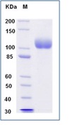 Human ACE2 / Angiotensin-Converting Enzyme 2 Recombinant Protein (His Tag)