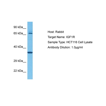 Human HCT116 Whole Cell