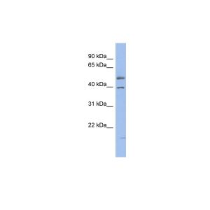 Human OVCAR3