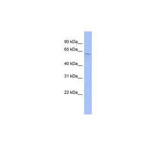 Human OVCAR-3