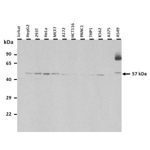 Western Blot