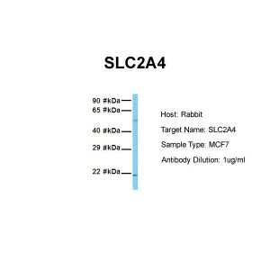 Human MCF7