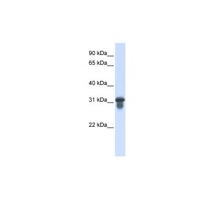 Transfected 293T 