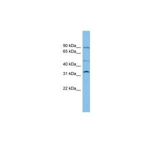 Human PANC1
