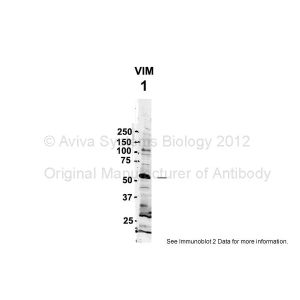 Human NT-2