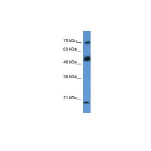 Human MCF-7