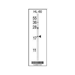 HL-60 cell