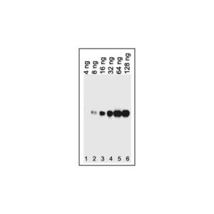 E Coli