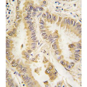 Human Lung