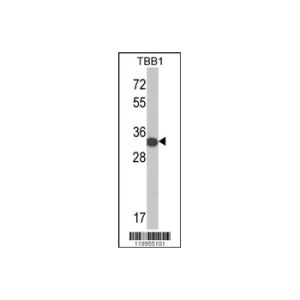 His-tag TBB1