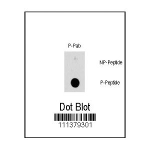 Phospho-peptide, non-phospho-peptide