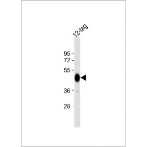 Human 12-tag protein
