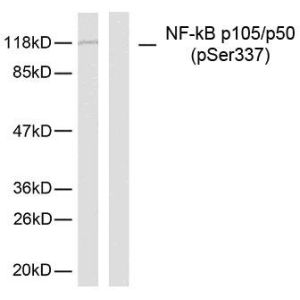MDA-MB-435 cells