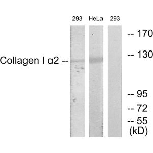 293/HeLa cells