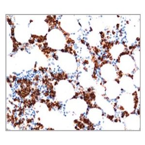 Human bone marrow