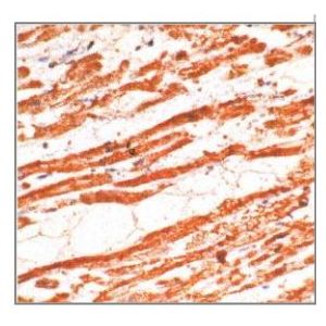 Human cardia muscle