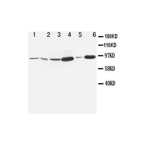 Rat Embryo, MM453, Hela, SMMC, Jurkat, HT1080