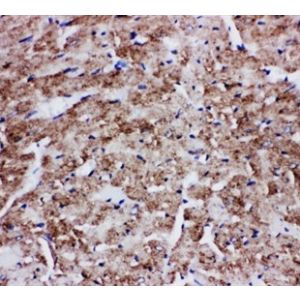 Rat Cardiac Muscle