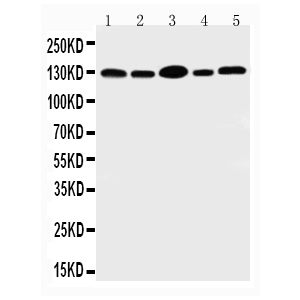 PANC Cell Lysate, HELA Cell Lysate, SW620 Cell Lysate, COLO320 Cell Lysate, A549 Cell Lysate