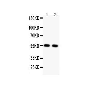 Rat Cardiac MuscleTissue Lysate, Rat Skeletal MuscleTissue Lysate
