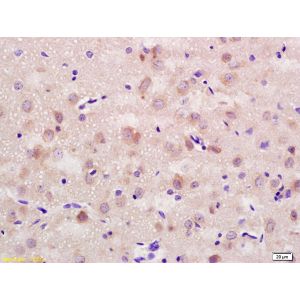 Rat brain