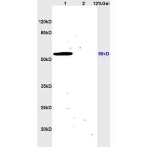 L1 mouse brain lysates L2 mouse heart lysates