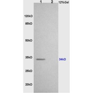 L1 rat brain lysates L2 rat heart lysates