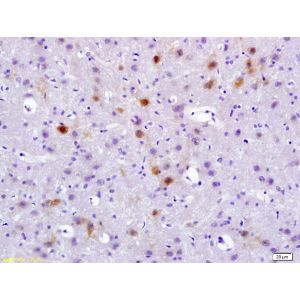 Rat brain