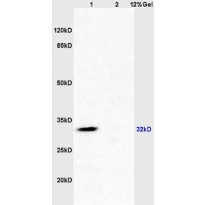 Lane 1: mouse brain lysates Lane 2: mouse kidney lysates