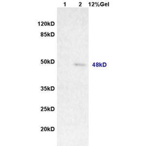 Lane 1: rat brain lysates Lane 2: human colon carcinoma lysates