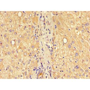 Human liver tissue