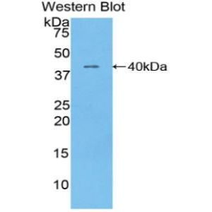 Troponin T, slow skeletal muscle