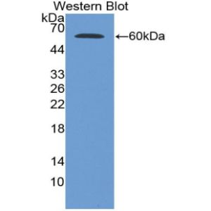Glucose-6-phosphate 1-dehydrogenase