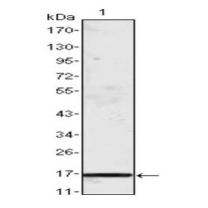 Truncated MCP-1 recombinant protein
