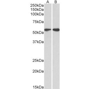 HeLa (A) and Jurkat (B) lysates