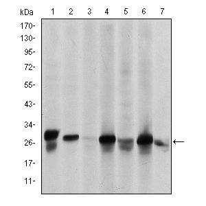 HepG2 (1), Hela (2), K562 (3), Jurkat (4), SKBR-3 (5), A431 (6) and Cos7 (7) cell lysate