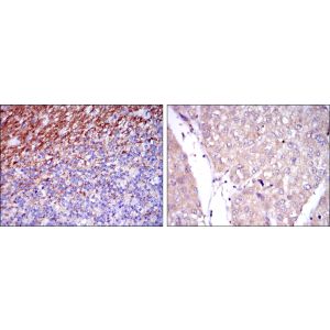 Human cerebellum tissues (left) and human liver cancer tissues (right)