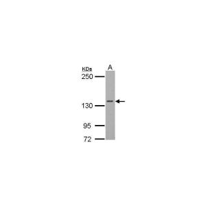BCL-1 