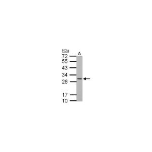 Neuro2A