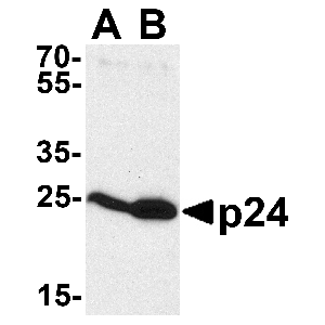 Recombinant HIV-1 p24.