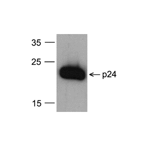 recombinant HIV-1 p24 protein