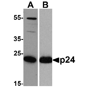 viral p24 and recombinant p24