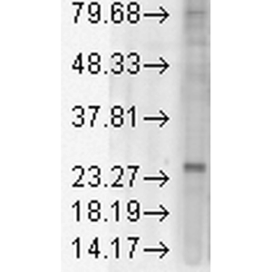 Western Blot